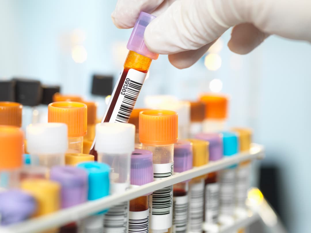 Test tubes in a lab.