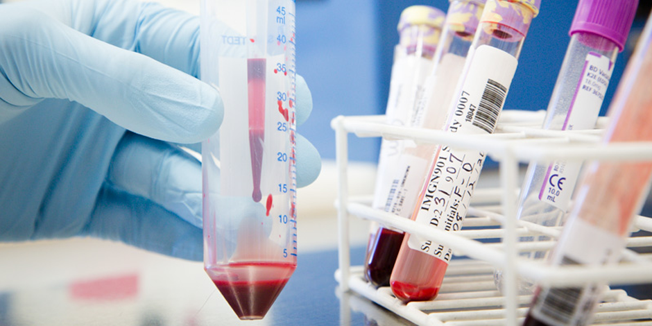 Early Detection Early Detection