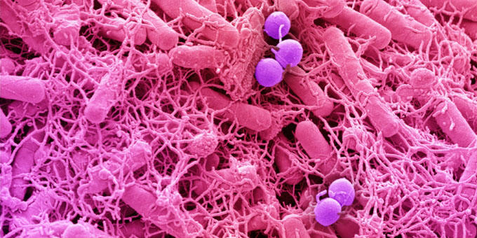Coloured SEM of bacteria cultured from a fingertip Coloured SEM of bacteria cultured from a fingertip