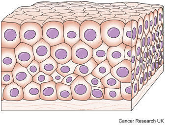 Diagram of transitional cells 