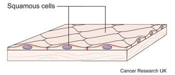 Diagram of squamous cells