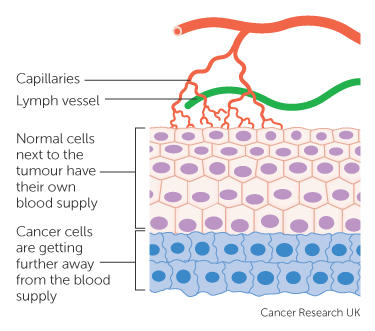 Normal cells and cancer cells pictures