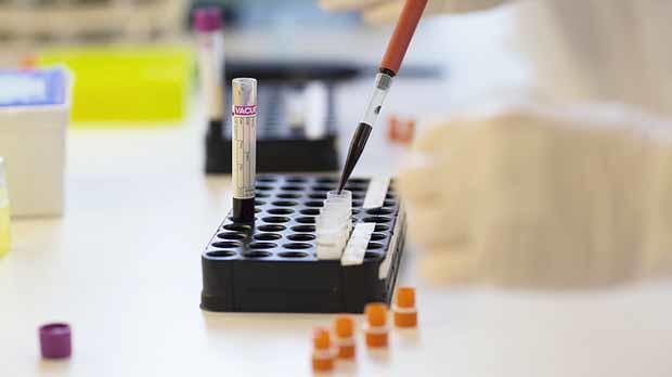 Blood sample image uploaded for news stories - image from Flickr - credit here: https://www.flickr.com/photos/ntnumedicine/14103766119/