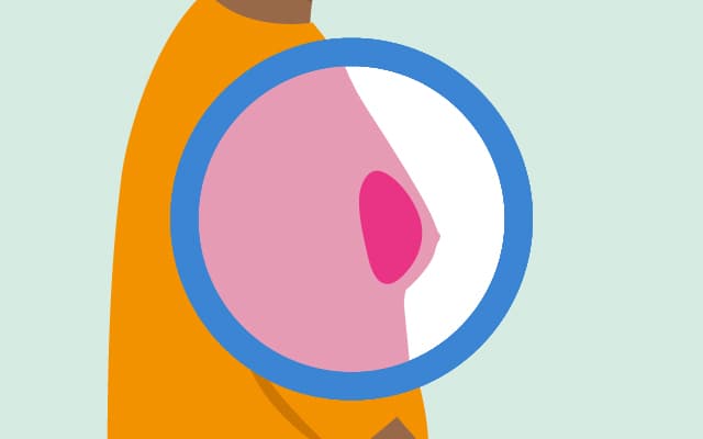 An illustration of a breast.