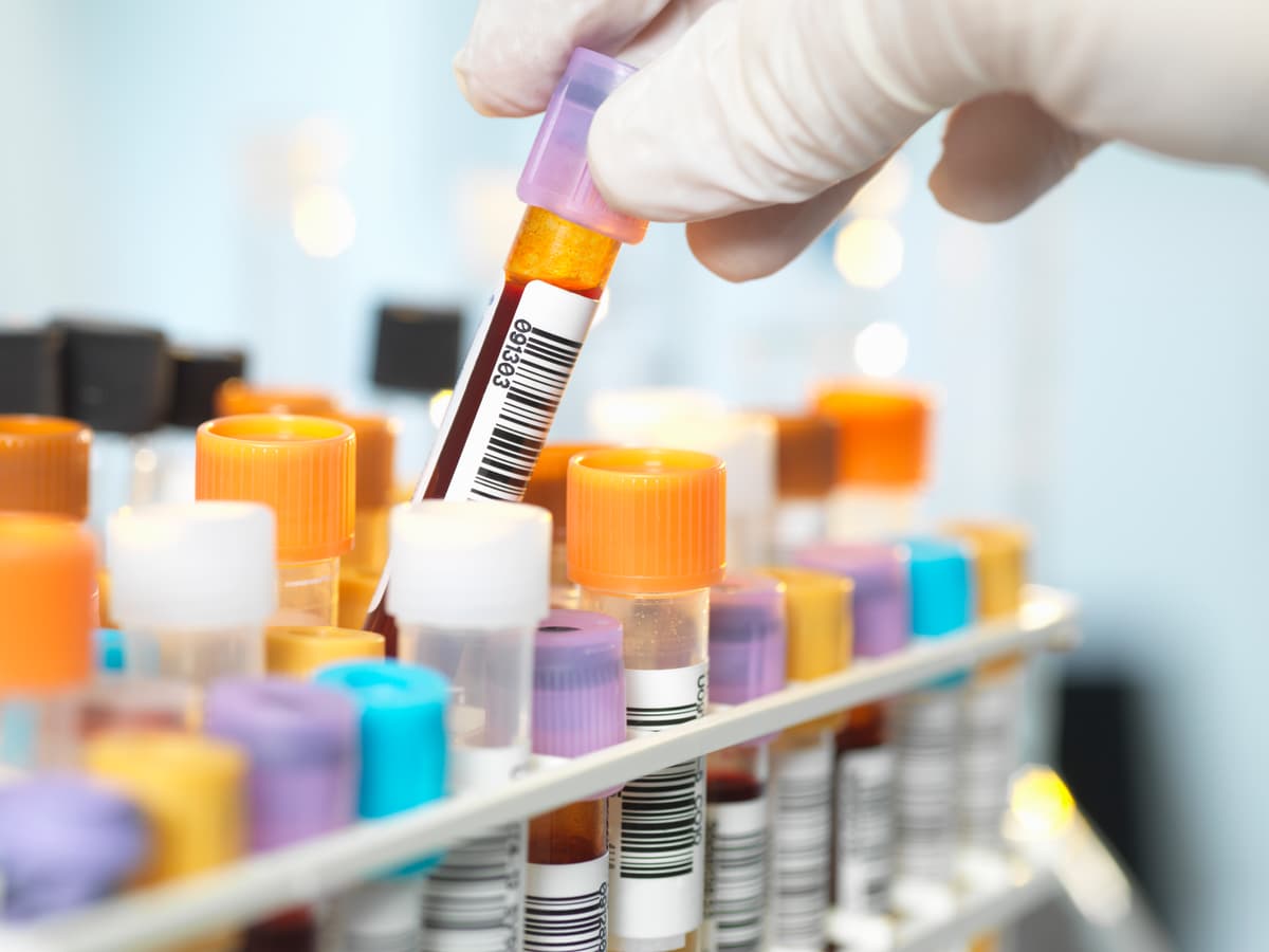 Test tubes in a lab.
