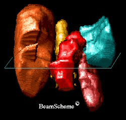 3D computer image.