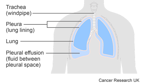SIMPLE diagram.