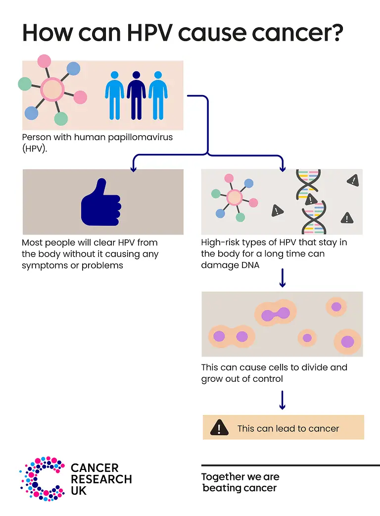 This infographic shows how HPV can cause cancer.