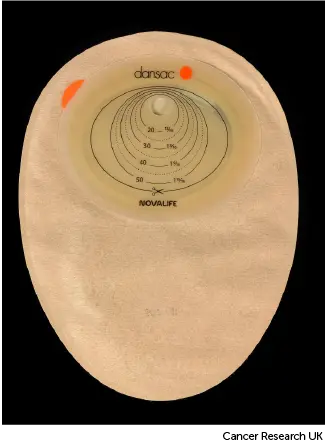 Photo showing the back of a colostomy bag.