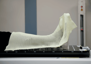 Photograph of radiotherapy mould of a leg.