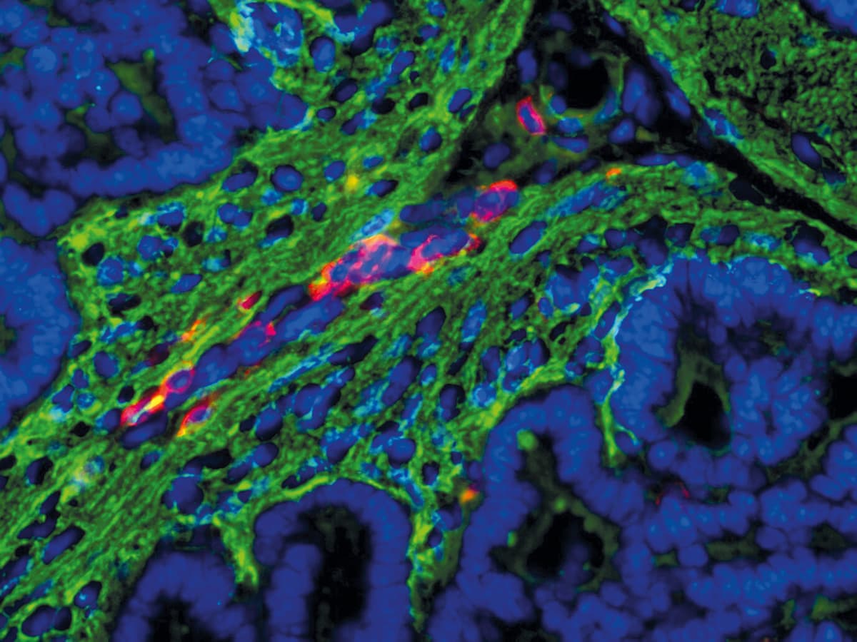 Microscopic image of fluorescent dye used to find cancer cells.