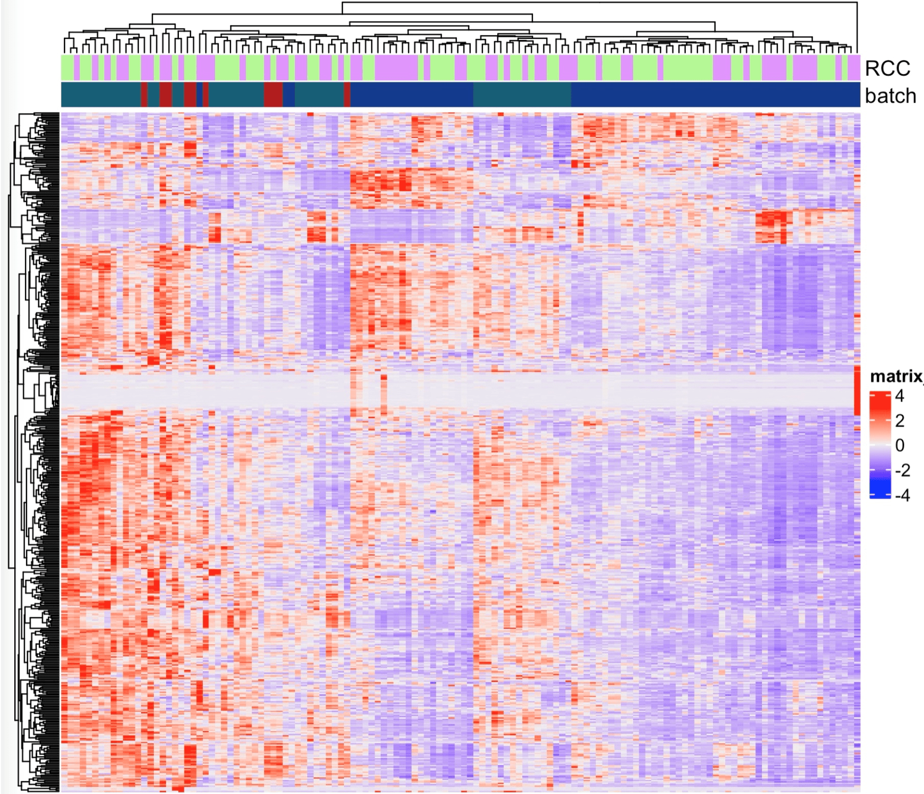 Hereditary kidney cancer.