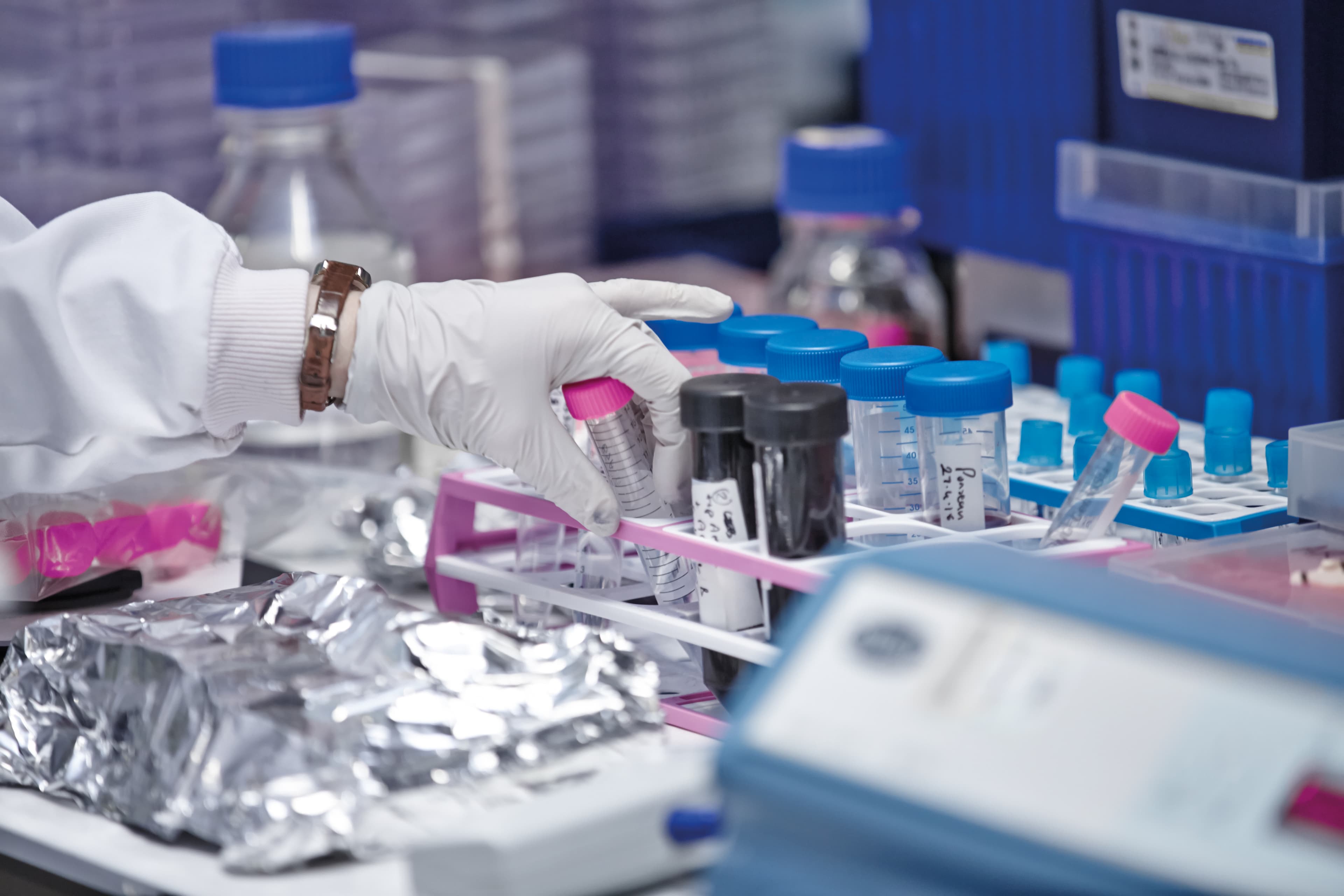A researcher taking a test tube from one of the racks of test tubes at Oxford Institute for Radiation Oncology.