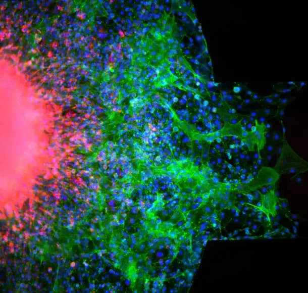 Joshua Daoud photo for Research is Beautiful image competition.