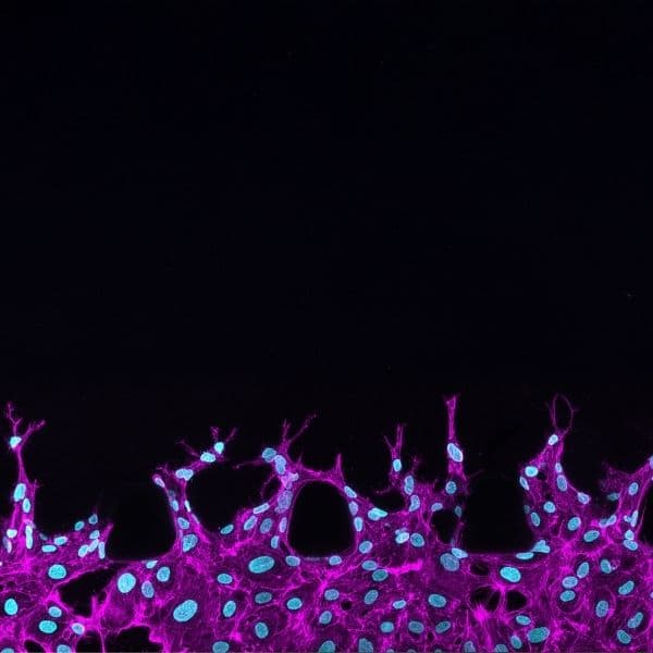 pink endothelial cells.