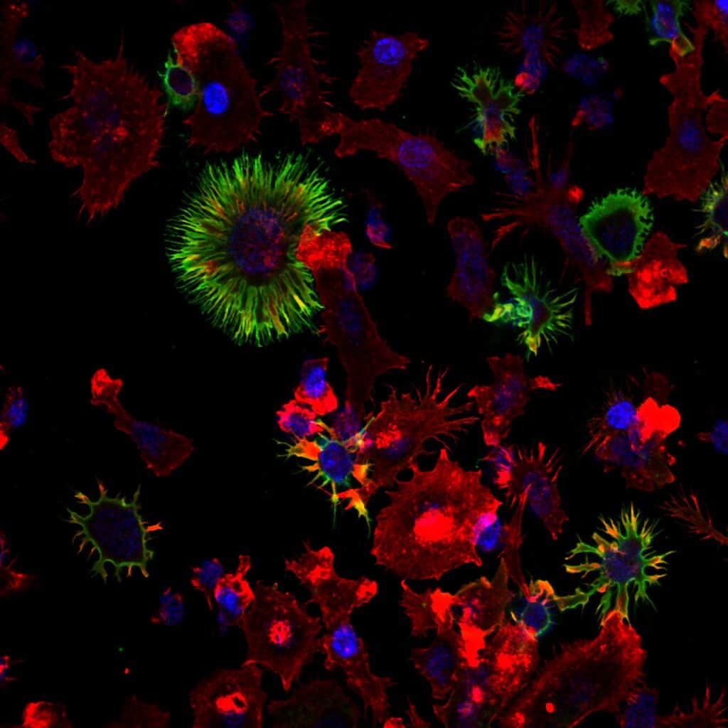 dendritic cells, science imagery.