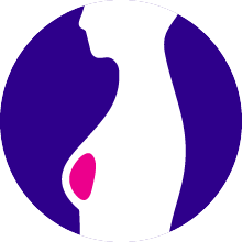 Breast Cancer