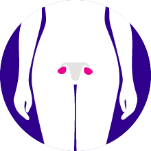 Ovarian Cancer
