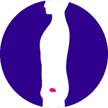 Prostate Cancer