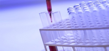 Blood in a test tube