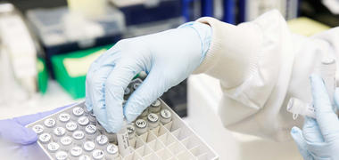 Researcher loading samples into a tray