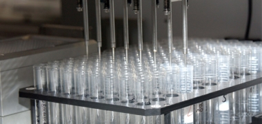 Samples being analysed by a machine in the lab