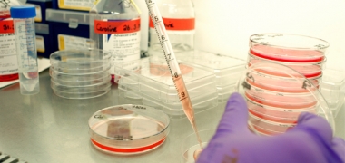 Cells being pipetted into a petri dish