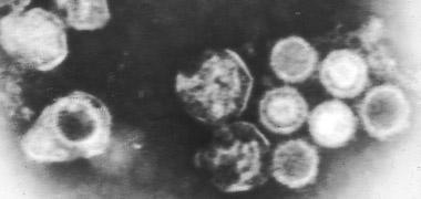 Epstein-Barr virus particles