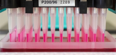 A machine pipetting samples in a lab