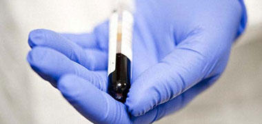 A scientist holding a small test tube containing a blood sample