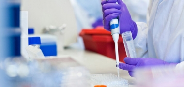 A scientist pipetting in a laboratory