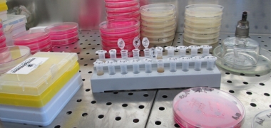 Samples in a laboratory