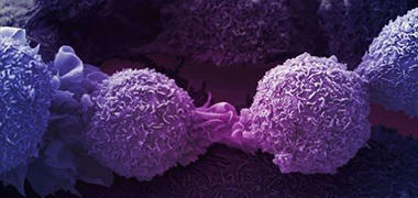 Lung cancer cells