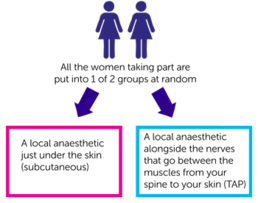 A trial looking at pain control after surgery for a gynaecological cancer (TAPAS).