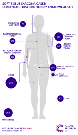 infographic showing the percentage distribution of soft tissue sarcoma incidence by anatomical site