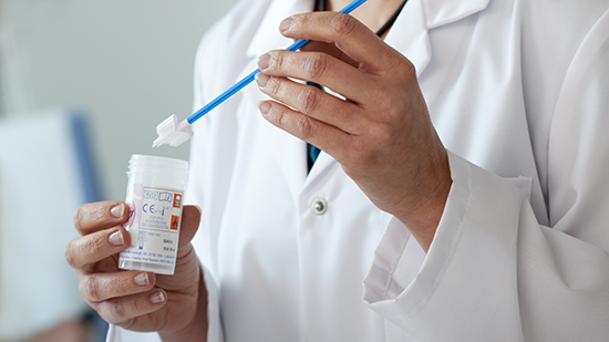image of health professional holding a cervical screening test