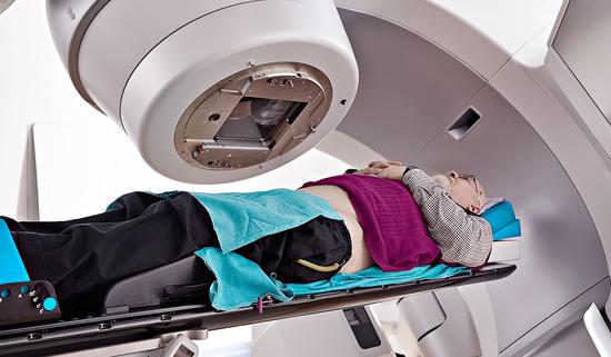 Radiotherapy