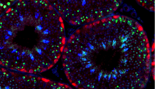 gene therapy