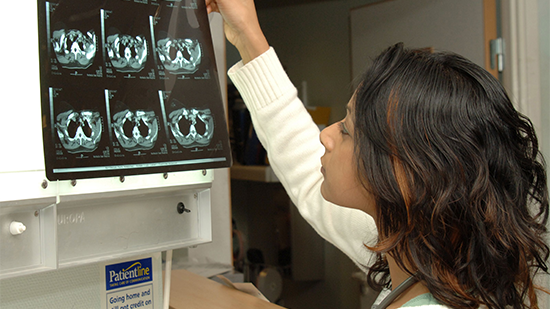 Photo of Doctor looking at scan results