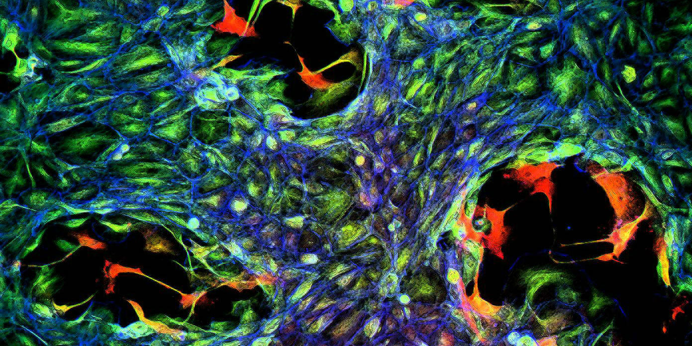 Cell Motility Laboratory at the LRI