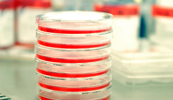 A stack of petri dishes