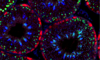 gene therapy