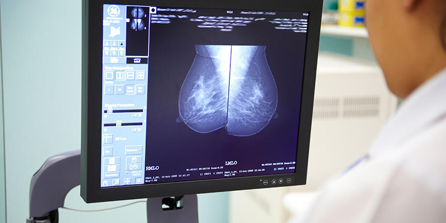Radiographer looking at mammogram image Radiographer looking at mammogram image