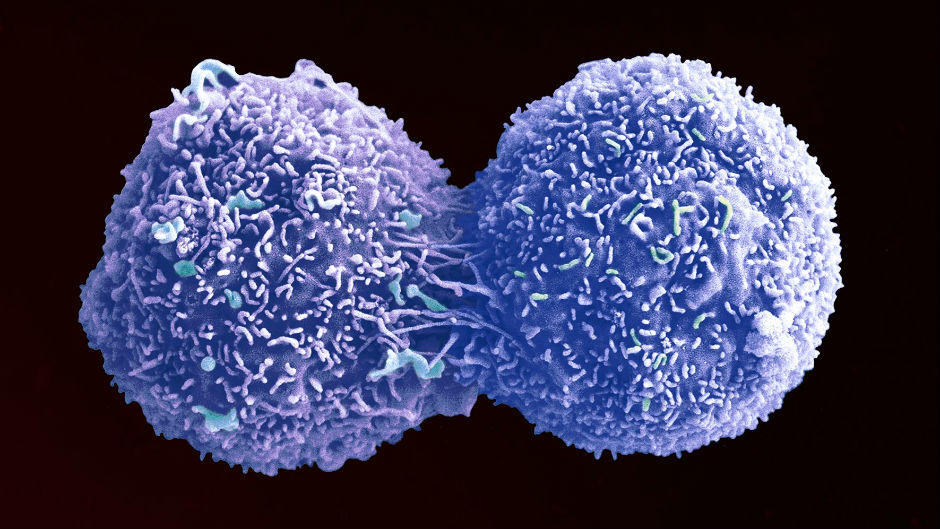 Lung Cancer Cells Lung Cancer Cells