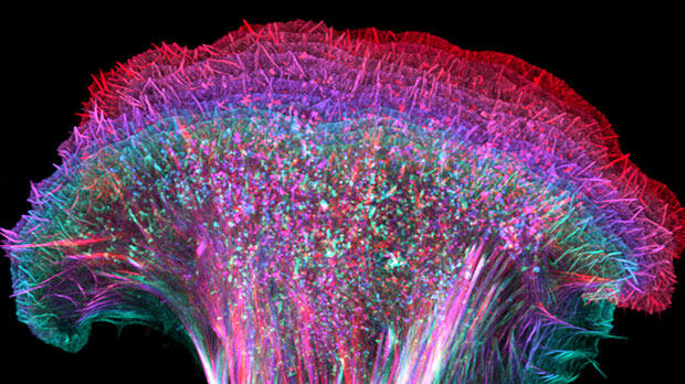 A colourful microscope image of mouse skin cancer cells