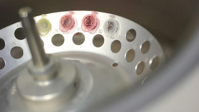 Samples in a centrifuge