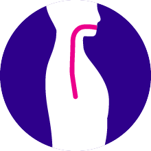 Oesophageal cancer Oesophageal cancer