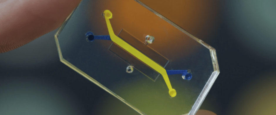 Organ-on-a-chip