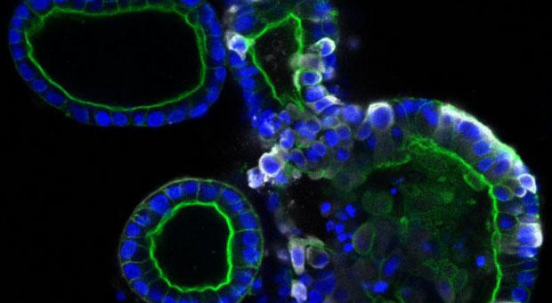 Coronavirus infects intestinal cells