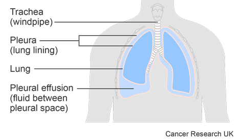 SIMPLE- Diagram
